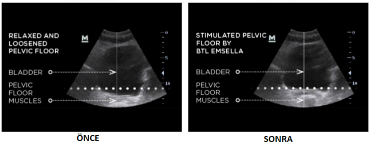 MUSPLUS-CHAIR-HIFEM-ESPLUS